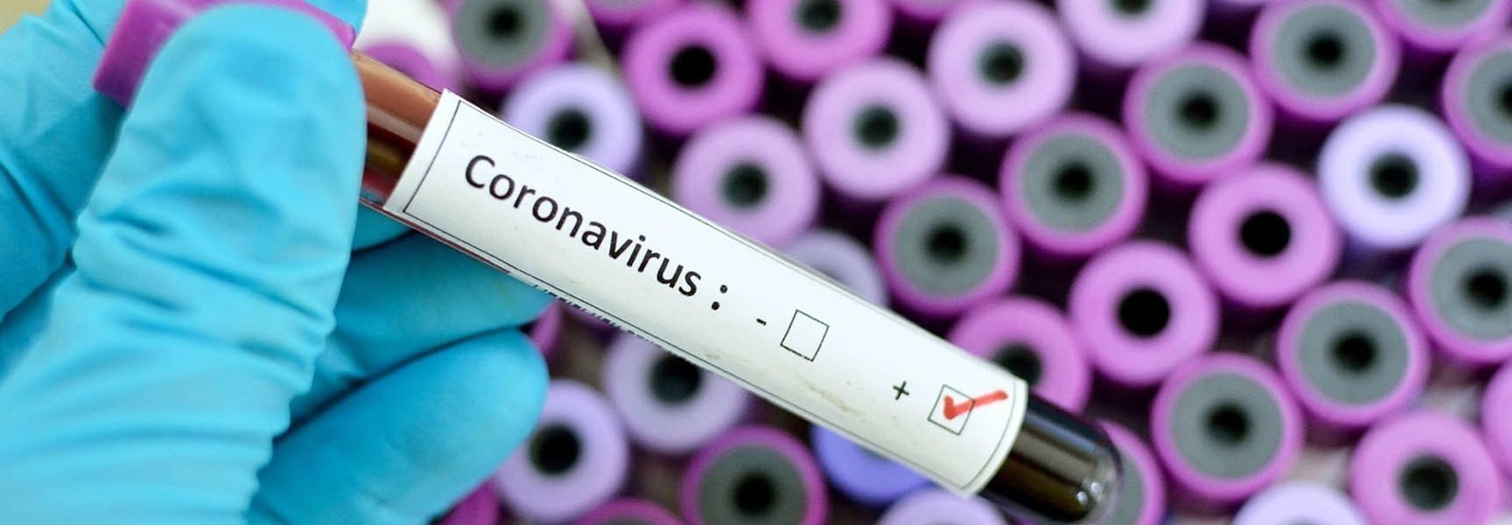 Understanding COVID-19 (Novel Coronavirus)